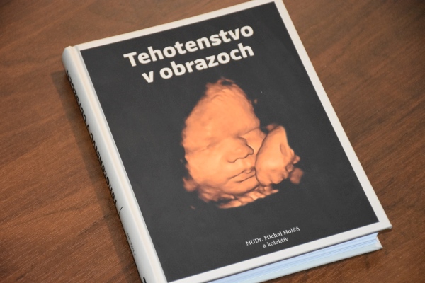 Tehotenstvo v obrazoch kniha